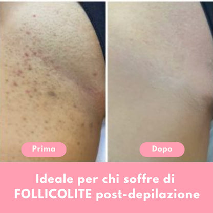 DermaGlide™ Depilatore