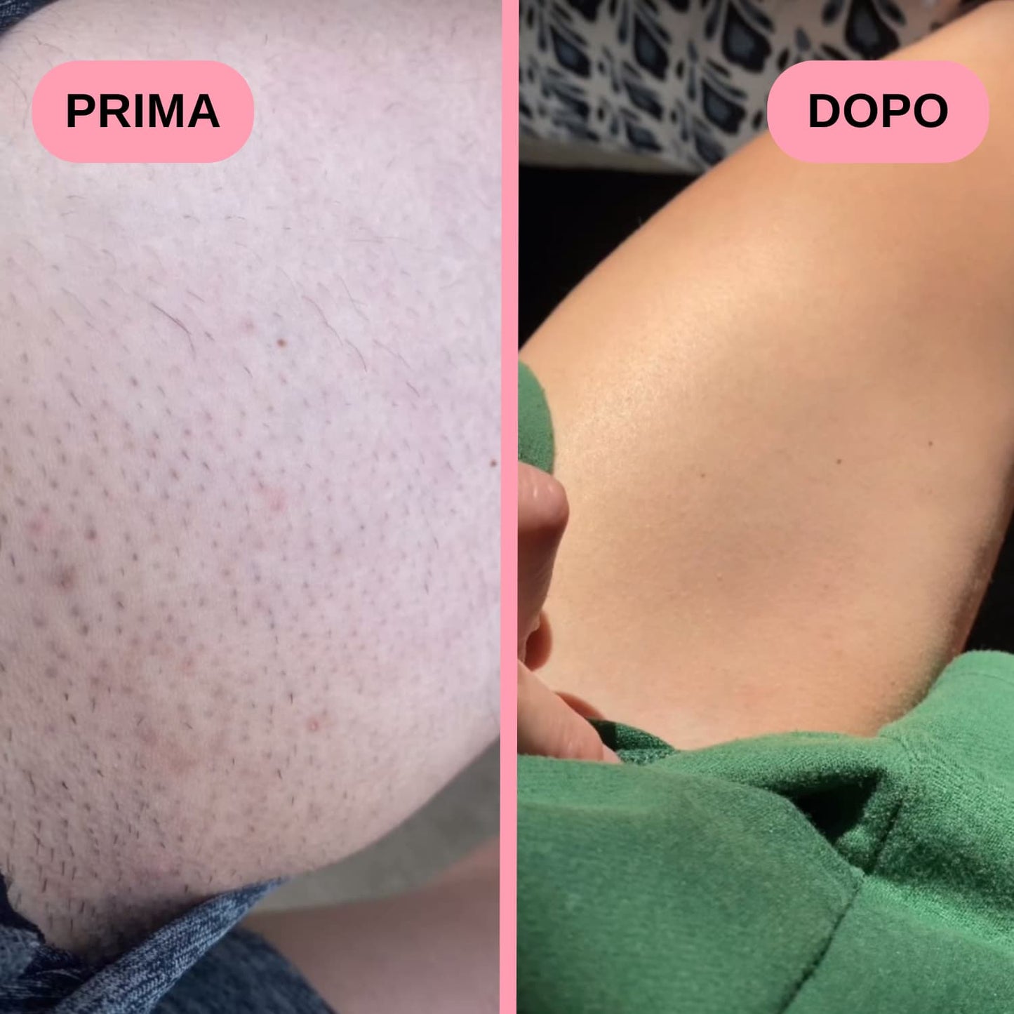 Guanto Esfoliante di DermaGlide
