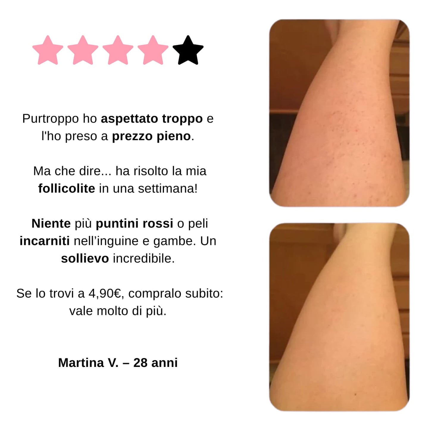 Guanto Esfoliante di DermaGlide